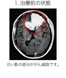 治療前の状態