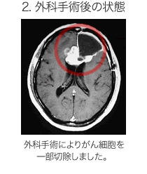 外科手術後の状態